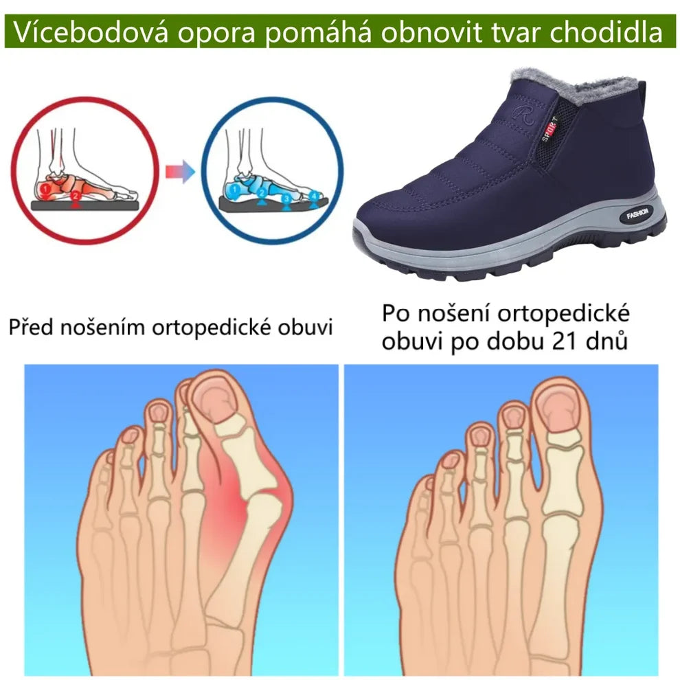 Zimní protiskluzové a zateplené boty pro muže i ženy se slabší rovnováhou – ulevují od tlaku na kolena(unisex)