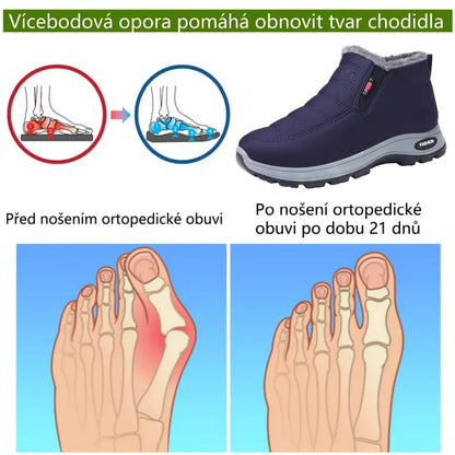 Zimní protiskluzové a zateplené boty pro muže i ženy se slabší rovnováhou – ulevují od tlaku na kolena(unisex)